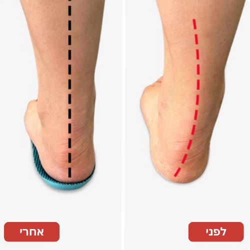אורתוסול - מדרסים אורתופדיים לתמיכה משופרת והקלה בכאבי רגליים