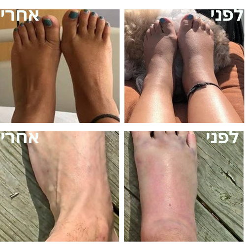 OrthoSocks - גרבי לחץ לשיפור זרימת הדם והקלה בכאבי רגליים
