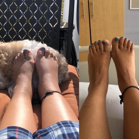 FootRevive™ Pro — מכשיר שיקום מתקדם בטכנולוגיית 3-ב-1 לכפות הרגליים והשוקיים